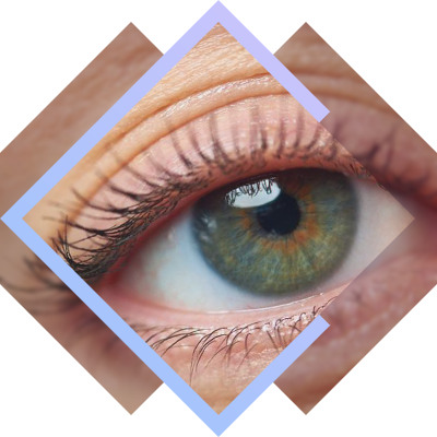 Cost cutting laser eye